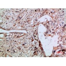 Anti-ENA-78 antibody