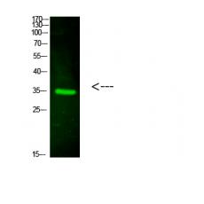 Anti-CTXL antibody