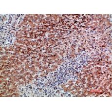 Anti-BMP-9 antibody