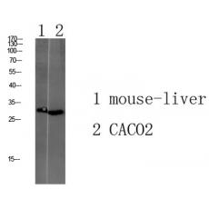 Anti-Tmem72 antibody