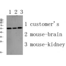 Anti-PLD4 antibody