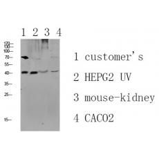 Anti-CCR5 antibody