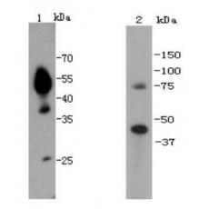 Anti-UTF1 antibody