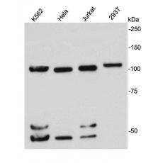 Anti-Nucleolin antibody