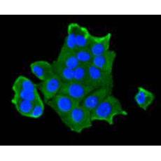 Anti-IGF2R/M6PR antibody