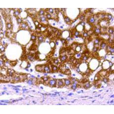 Anti-Prohibitin（Mitochondrial Marker） antibody