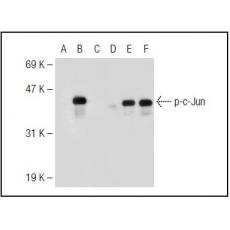 Anti-c-Jun antibody