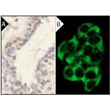 Anti-eIF2α antibody