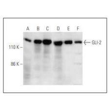 Anti-Gli2 antibody