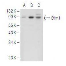 Anti-STIM1 antibody