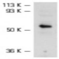 Anti-ILK antibody