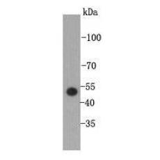 Anti-P53 antibody