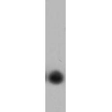 Anti-IL-6 antibody