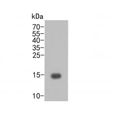 Anti-TNF alpha antibody