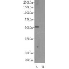 Anti-Autoimmune regulator (AIRE) antibody