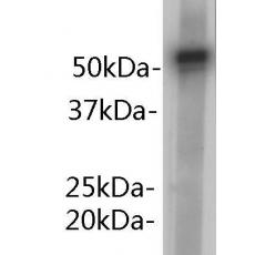 Anti-alpha 1-antitrypsin antibody