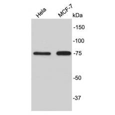 Anti-P63 antibody