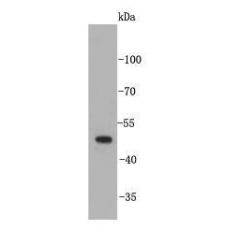 Anti-Angiopoietin-like 4 antibody