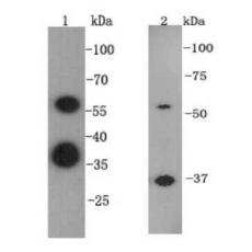 Anti-ESRRB antibody