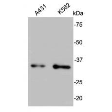 Anti-BCL2L1 antibody