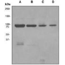 Anti MLH1 antibody 抗体 生命科学 泽叶生物网站