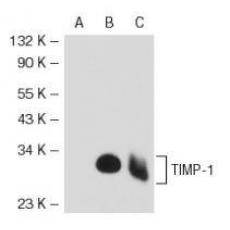 Anti-TIMP-1 antibody