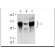 Anti-TTF1 antibody
