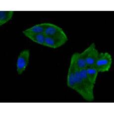 Anti-MLCK antibody