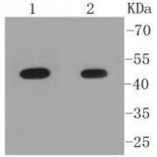 Anti-Pygopus 2 antibody