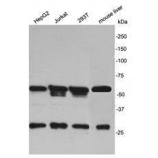 Anti-MKRN2 antibody
