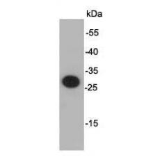 Anti-VSV-g Tag antibody