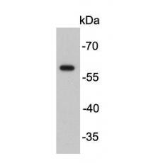 Anti-Restriction enzyme FokI(Internal) antibody