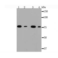 Anti-Ku80 antibody