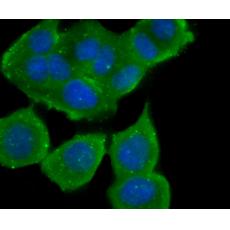 Anti-B7-H4(VTCN1) antibody