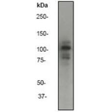 Anti-E-Cadherin antibody