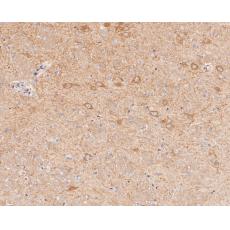 Anti-GABRA1 antibody