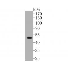 Anti-GABRA1 antibody