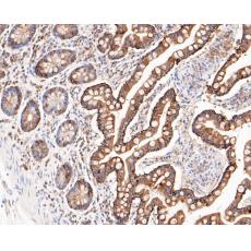 Anti-Cytokeratin 20 antibody