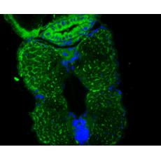 Anti-DARS2 antibody