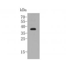 Anti-D14 antibody