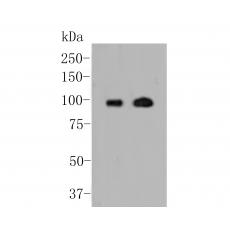 Anti-Androgen Receptor antibody