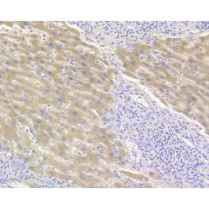 Anti-Complement factor B antibody