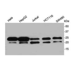 Anti-Y14 antibody