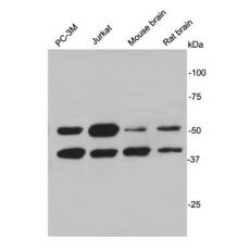 Anti-CUGBP Elav-like family member 2 antibody