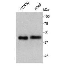 Anti-Cathepsin B antibody