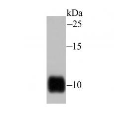 Anti-IL-8 antibody