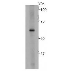 Anti-BMPR1A antibody