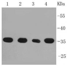 Anti-PP2A(alpha+beta) antibody