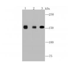 Anti-EGFR antibody