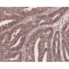 Anti-CCL2/MCP1 antibody